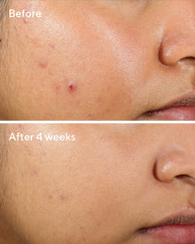 Murad | Clarifying Water Gel