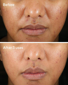 Murad | Rapid Relief Sulfur Mask