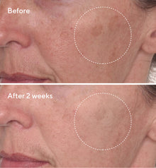 Murad | Rapid Dark Spot Correcting Serum