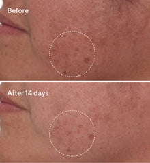 Murad | Rapid Dark Spot Correcting Serum