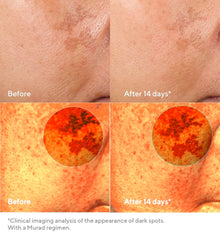 Murad | Rapid Dark Spot Correcting Serum