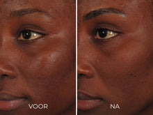 Image | ILUMA - Intense Facial Illuminator - Delizia Skincare